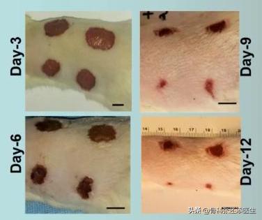 再生修复PRP是神物吗，是否存在夸大营销？骨科医生告诉你