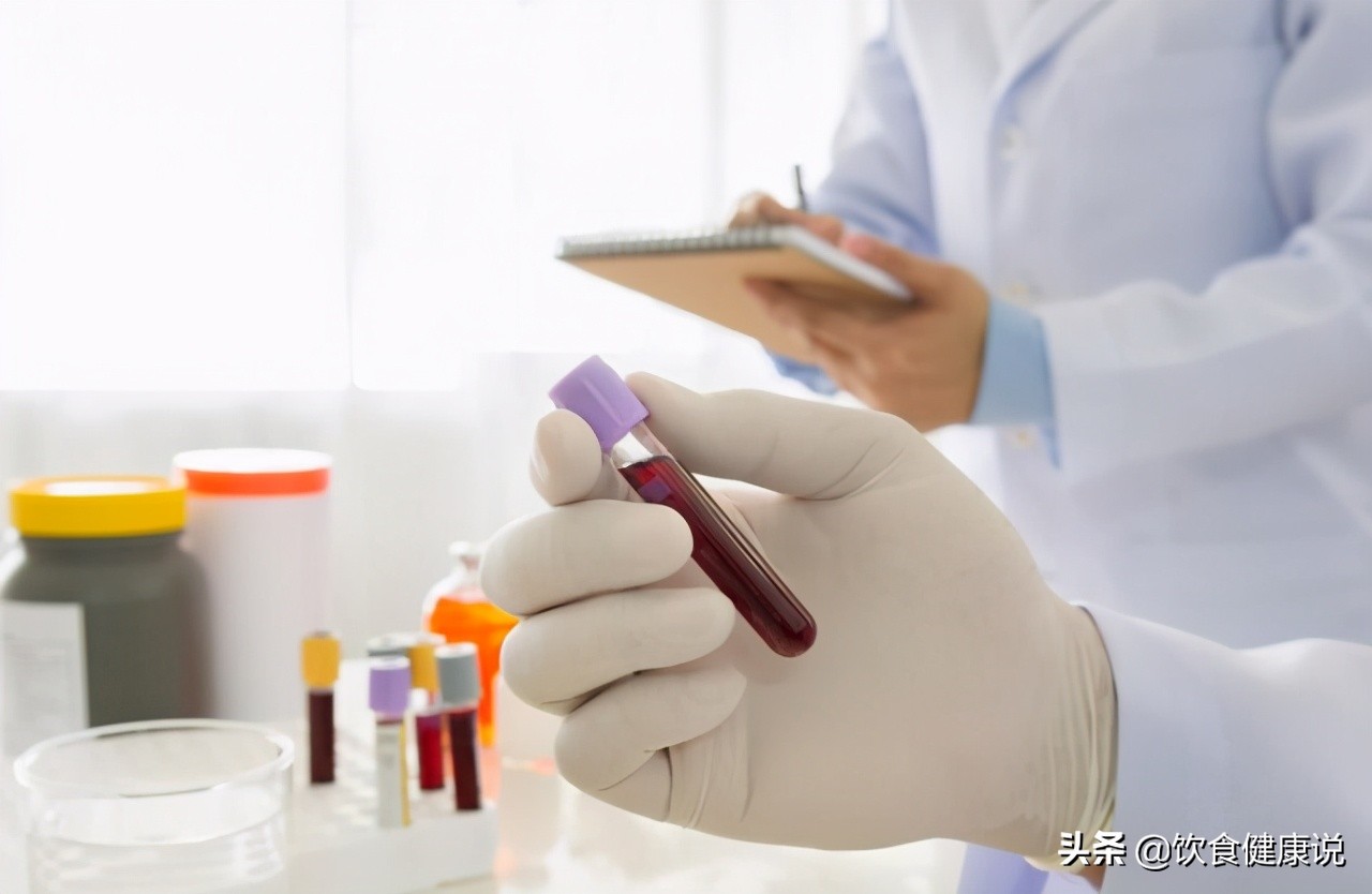 血常规检查有三个指标要注意,血常规检查主要看哪几项