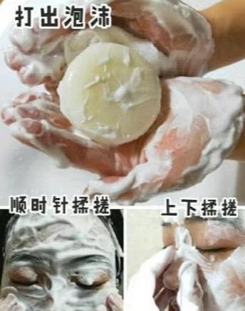 脸上粉刺留下硬块怎么去除,脸上一粒粒的粉刺怎么消除