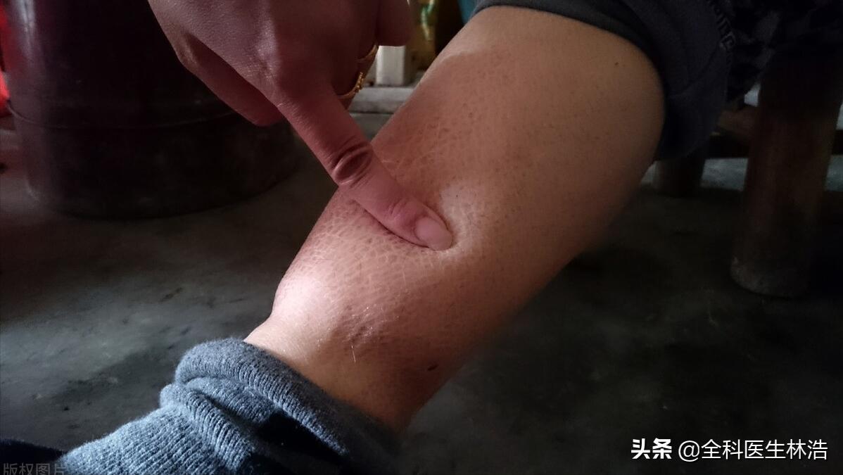 中医教你如何调理脾胃,中医如何教你调理脾胃