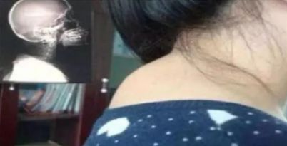 脖子难受怎么办呢,脖子不舒服该怎么办