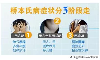 甲状腺球蛋白抗体，过氧化物酶抗体升高？深入浅出解释桥本病