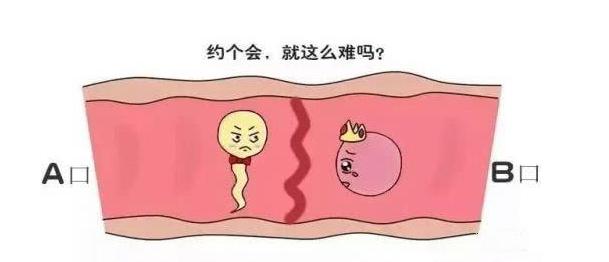 输卵管堵塞手术疏通多少钱,输卵管堵了怎么办啊