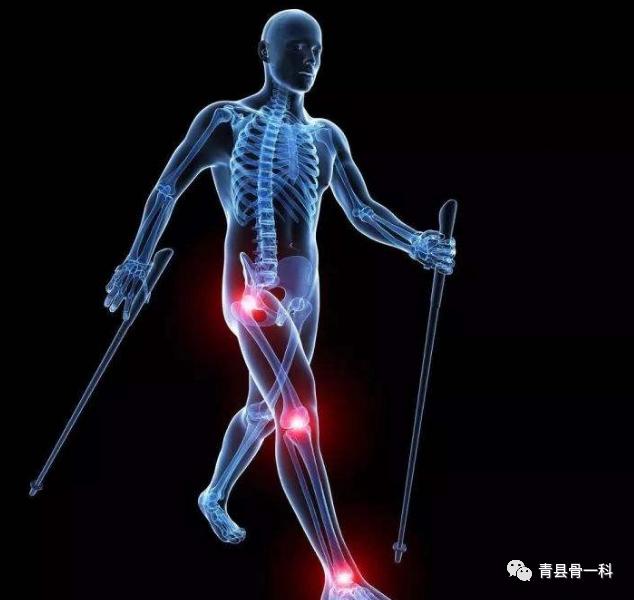 腿疼膝盖积液是什么原因,腿疼膝盖响是什么原因呢