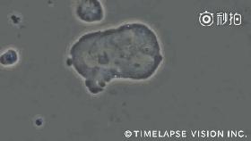 nk细胞疗法可以用于健康人群吗,肿瘤nk细胞疗法