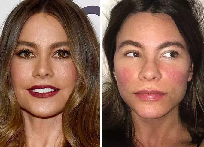 戚薇面部护肤方法,戚薇皮肤护理