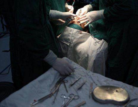 切除子宫和正常女性的区别,女人切除了子宫和卵巢会老得快吗