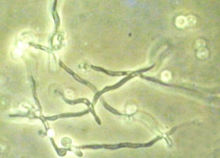 超级真菌是什么,美国超级真菌是怎么回事