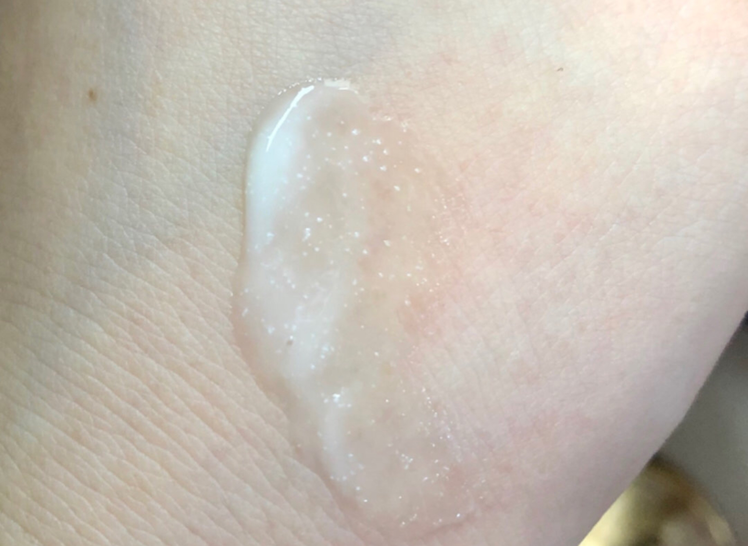 热门的祛痘精华,热门祛痘精华功效与作用