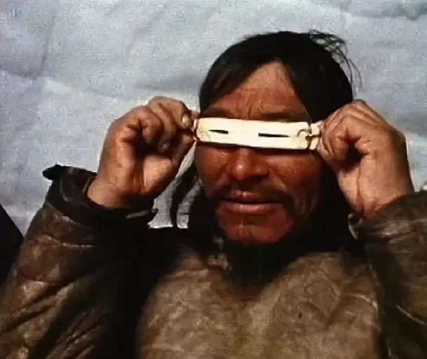 新生儿青色皮肤是不是胎记,新生儿青斑是中国人才有的吗