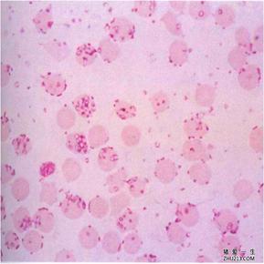 病猪全身发红怎么回事,病猪吃食正常肚上有红豆样疹子
