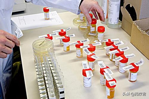 高血压肾病的早期表现尿色深,肾病综合征尿色发白正常吗