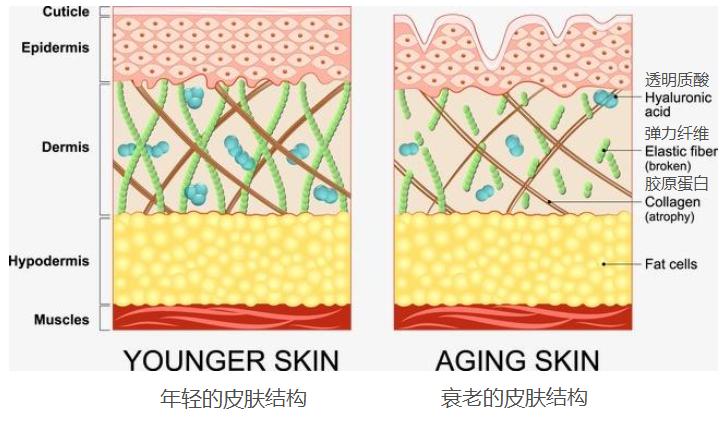 20岁有细纹怎么消除,25岁有皱纹用什么护肤品抗皱好