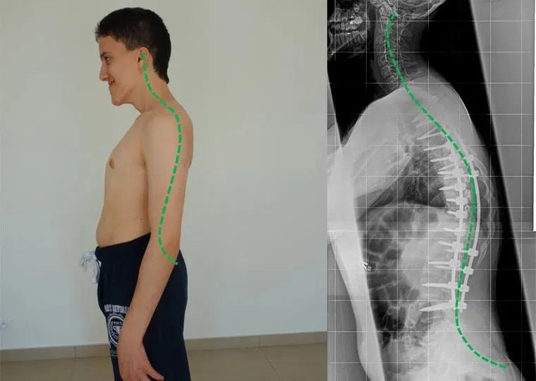 sps鍒涘浜虹悊鏌ュ痉,鐞嗘煡寰蜂翰鎺坰ps瀵煎笀
