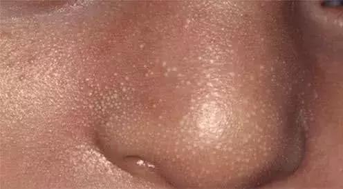 勃起、大姨妈，宝宝一出生就有这些羞羞的动作，正常吗？