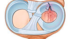老人膝盖疼平时应怎么样康复锻炼,老年人膝盖后面肌肉疼痛怎么回事