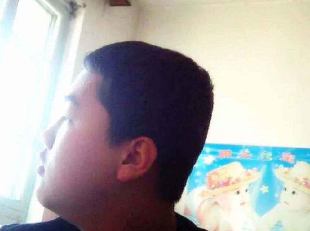 孩子头型偏了是不是扎辫子都不正,5个月宝宝头型不正还可以纠正吗