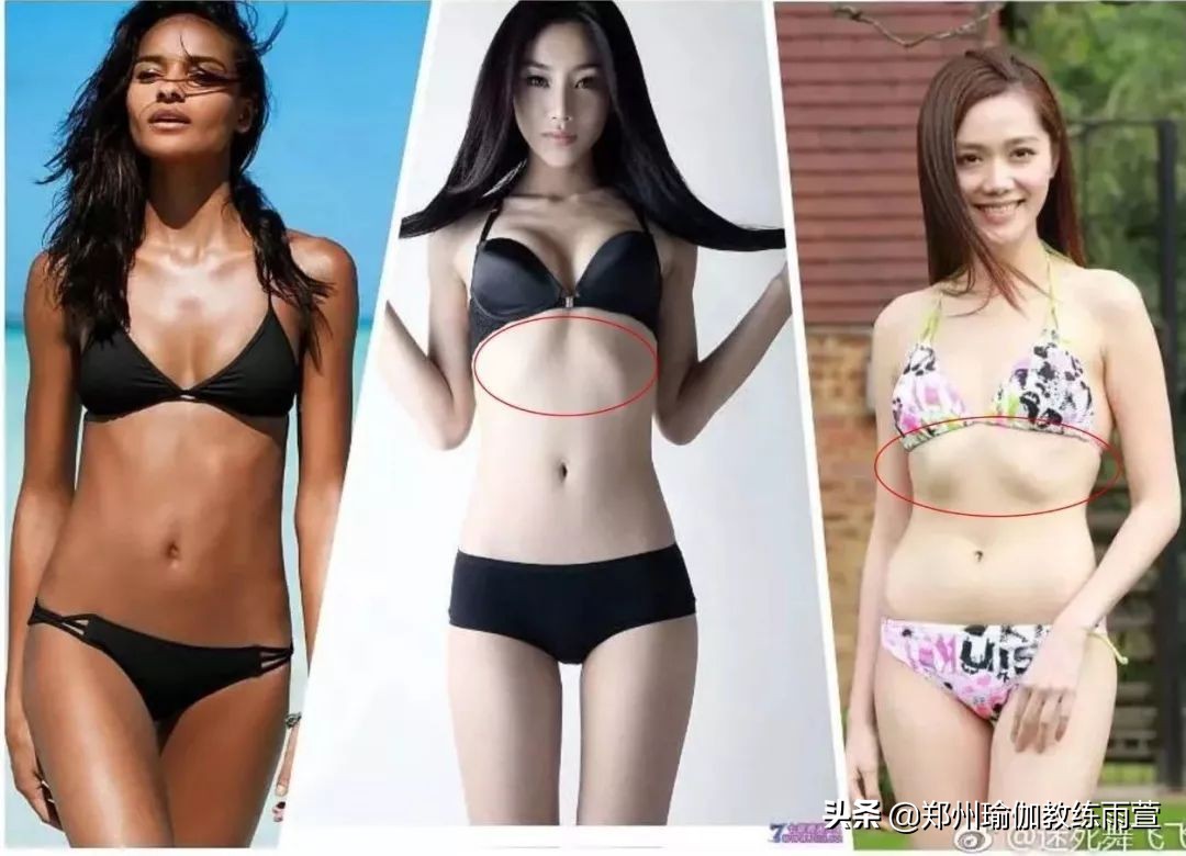 有肋骨外翻，锁骨窝凹陷，腰部疼痛的症状吗？你需要重新认识呼吸