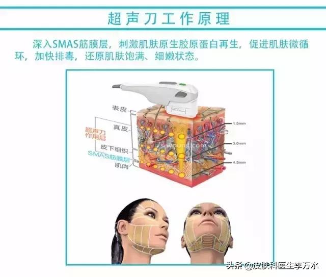 张雨绮说超声刀就像在烤肉?!线雕和超声刀,究竟哪个更靠谱?