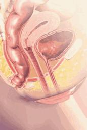 生孩子是必须要住院吗,女人顺产必须侧切吗