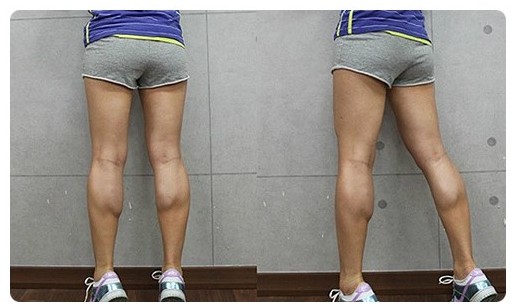 跑步一年小腿终于变细,跑步一年多了腿为啥还粗