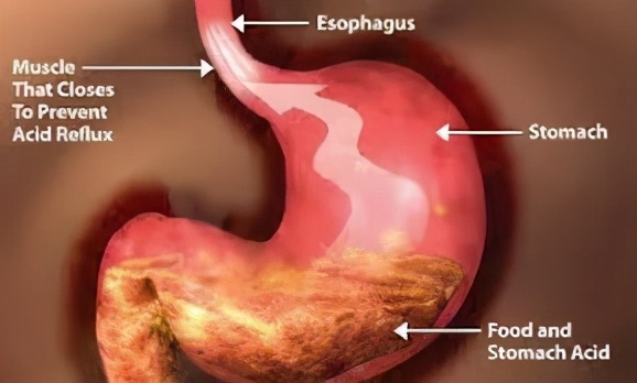 消化特别不好怎么治疗,消化不良怎么办这份良方请收藏
