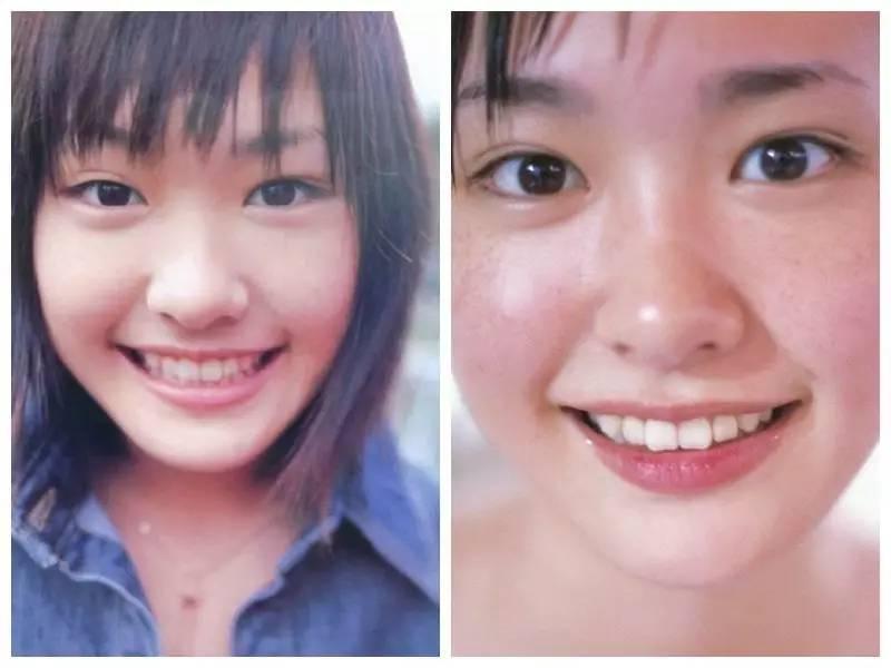 日本整容的鬼斧神工，来见识一下各位日星是整容了还是“长开”了