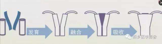 子宫发育异常，应想到的6大类常见畸形