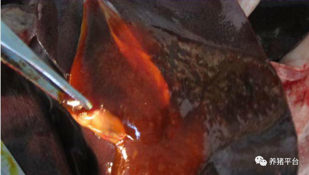 溶血性黄疸吃什么中药降下来,溶血性黄疸吃什么能快速降下去