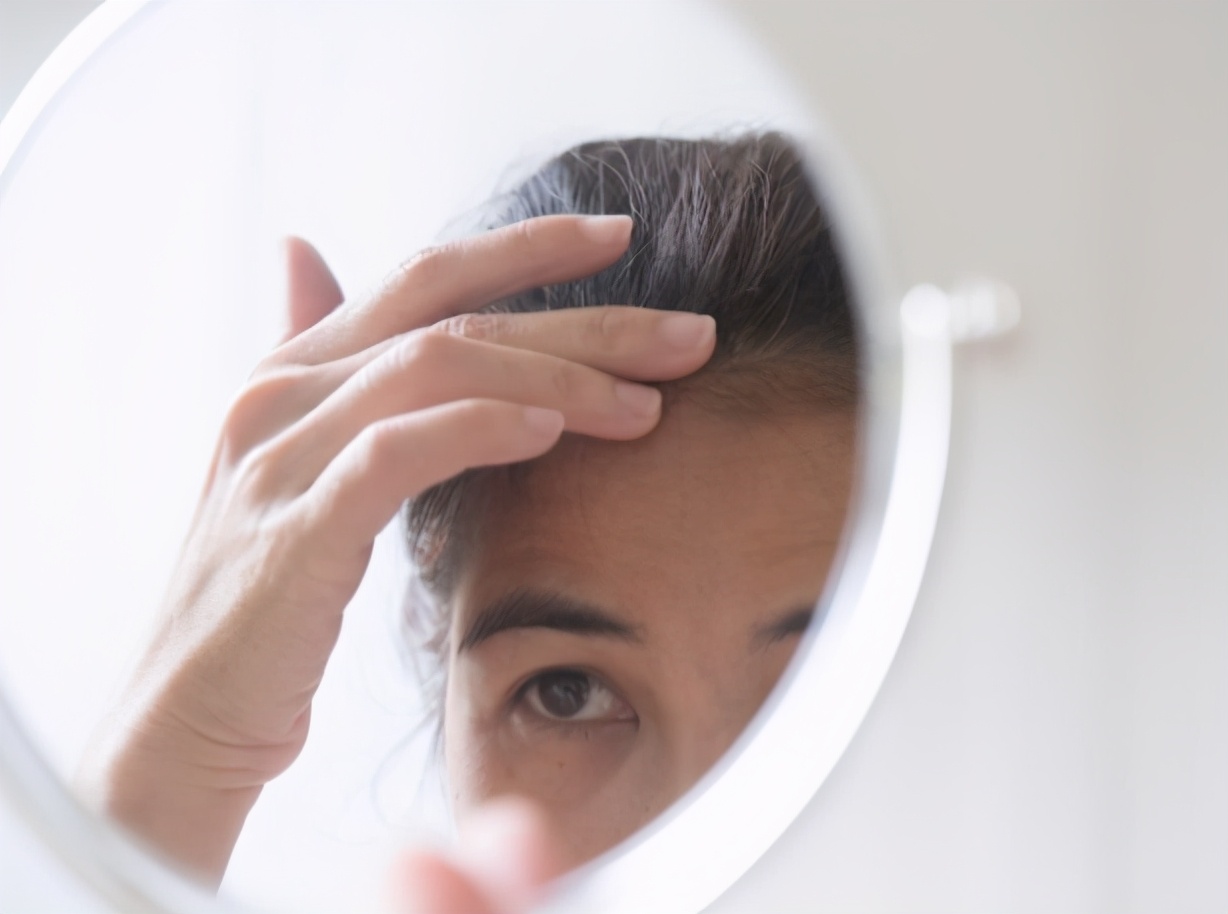 发际线掉发是什么原因造成的女性,发际线后移脱发的原因和治疗方法