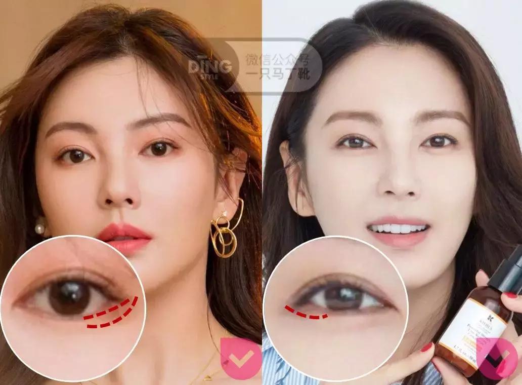 张雨绮杨丞琳对比,张雨绮眼型分析