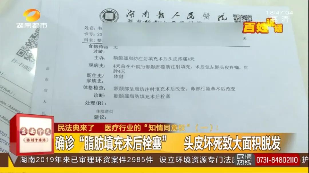 长沙29岁小伙接受5项整形，术后头皮坏死致大面积脱发！《民法典》侵权责任编：须告知医疗风险并征得同意