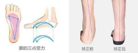脚上多长了块骨头,腿关节多长了一块骨头