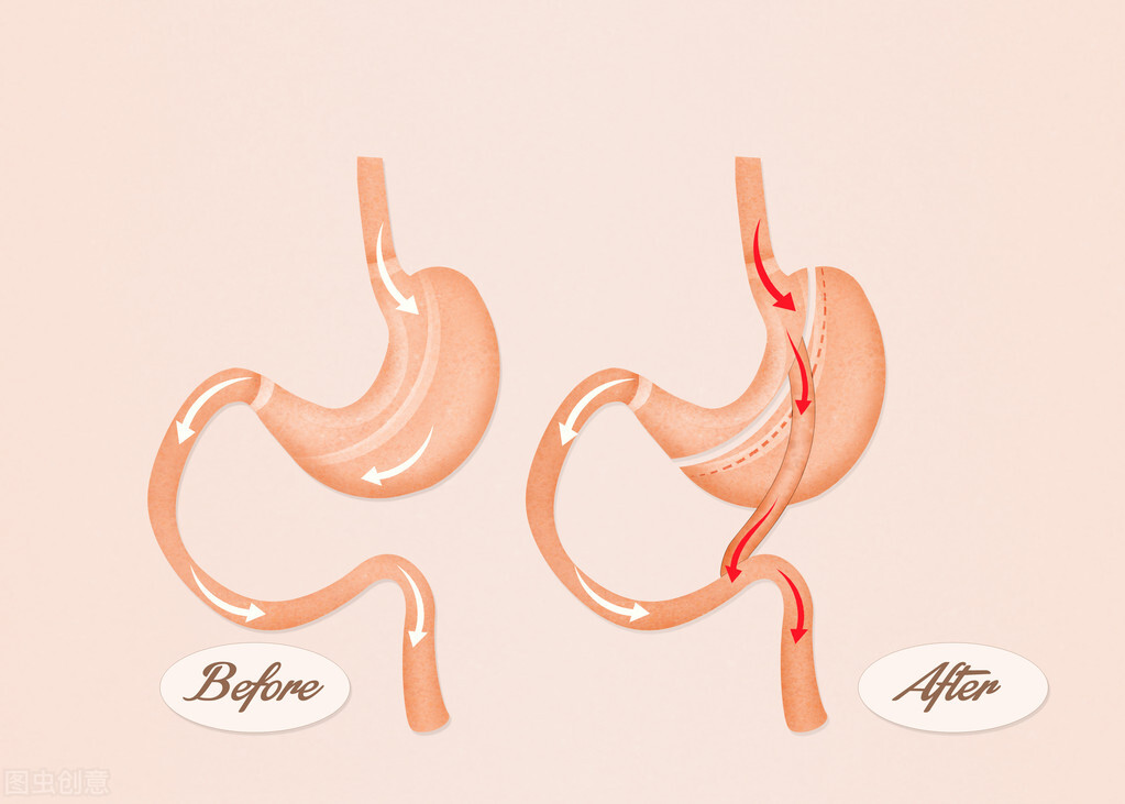 肚脐眼左边三寸处疼痛是什么原因,肚脐眼右上方3-5厘米按压疼痛