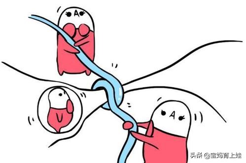 树袋宝宝的锻炼方法,树袋宝宝