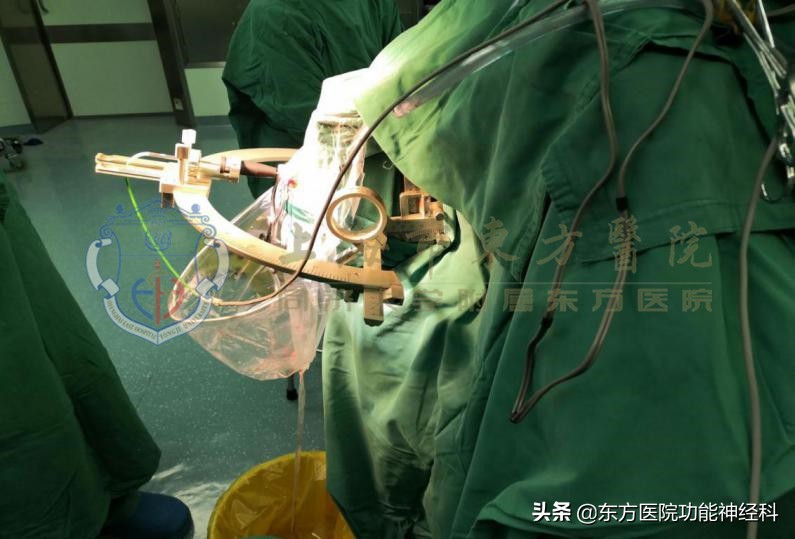 精分症患者反应迟钝,精分患者为什么举止怪异