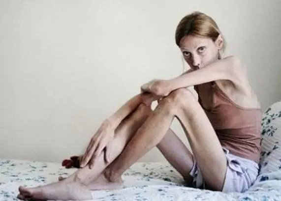 权威发布减肥产品,曝光10款减肥产品