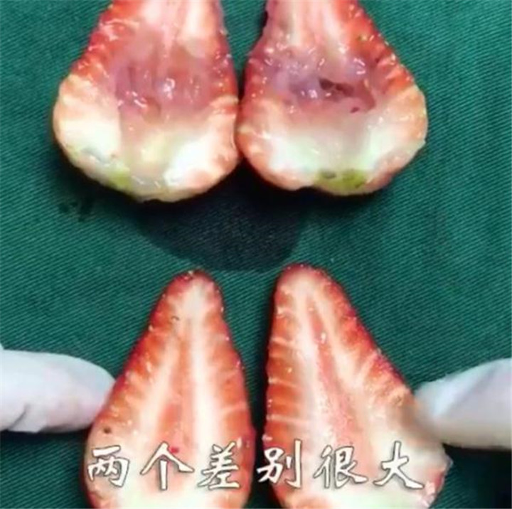 人流的危害科普,人流是不是越年轻伤害越大