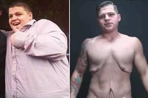 快速减肥后皮肤松弛怎么快速增肌,快速减肥肚子皮肤松弛