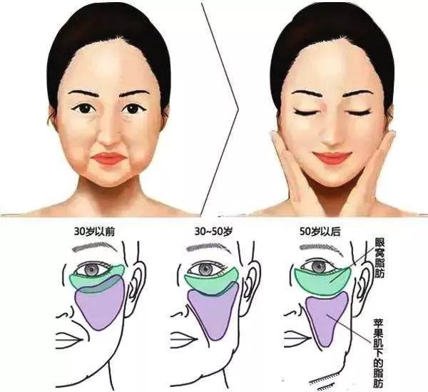 陈乔恩苹果肌 (陈乔恩苹果肌的照片)