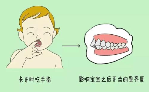 牙性龅牙和骨性龅牙的治疗费,大龅牙是什么