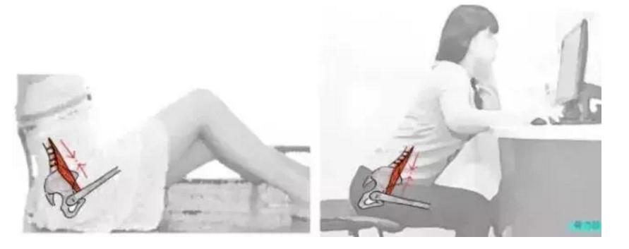 久坐腰痛大腿外侧疼的缓解方法,久坐腰痛的缓解方法微创手术