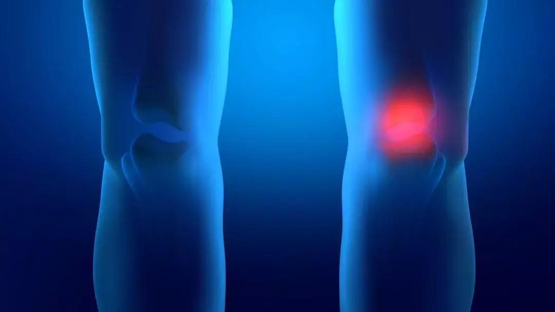 光华医院膝关节置换怎么样,膝关节置换后康复训练湖南四院