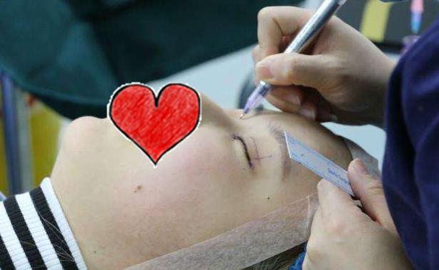 双眼皮术后三个月还肿是失败了吗,双眼皮术后宽度是最终效果吗