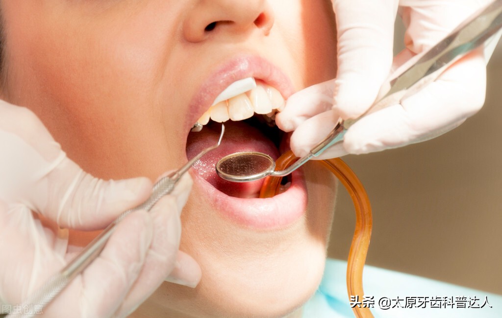 龋坏的牙齿自己掉后能补吗,5岁小孩牙齿龋坏了治疗费用