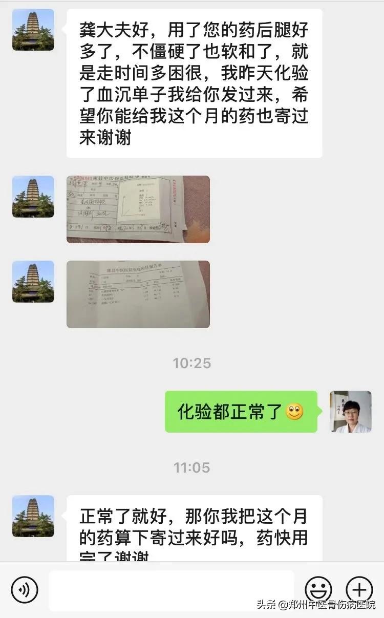 双侧股骨头坏死治愈后,骨坏死半年