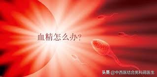 精子发黄是不是有病,精子发黄是不是肾有毛病