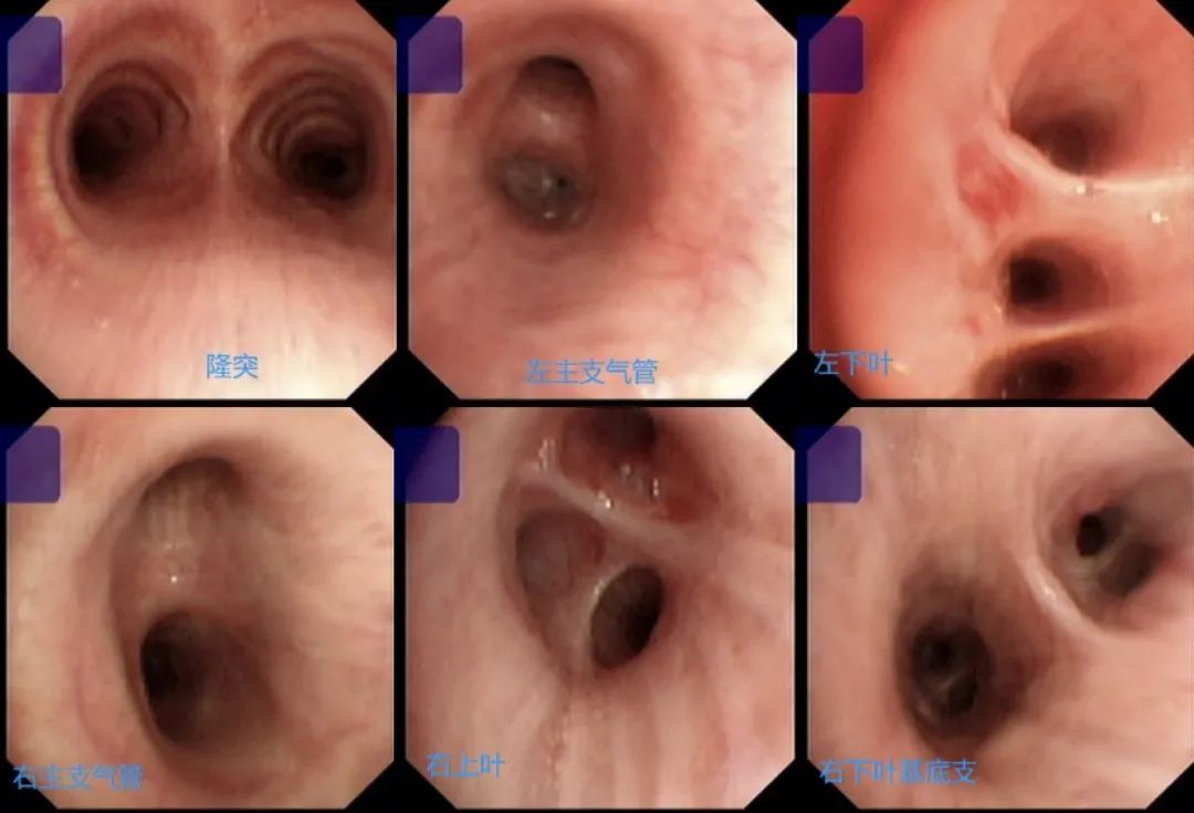 因医生误诊导致病情加重,为什么医院一些炎症一直治不好