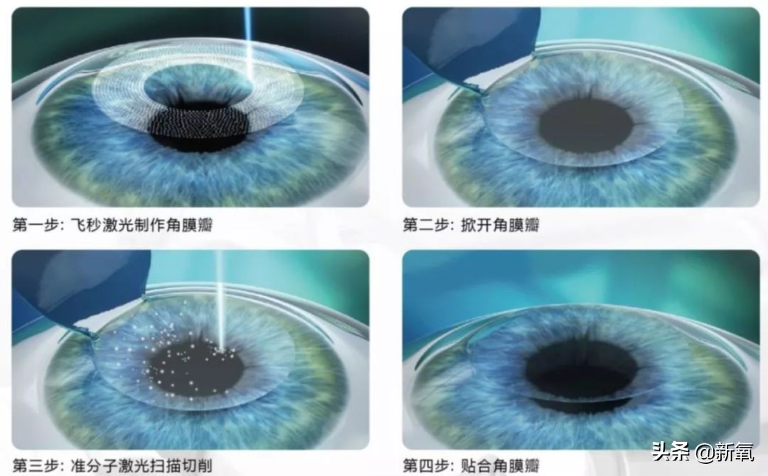 杨超越的眼睛大而无神,杨超越眼神空洞