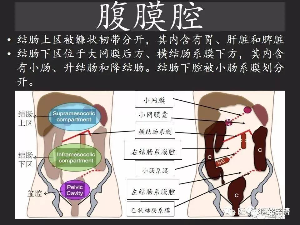 空腔脏器穿孔和胃肠道穿孔区别,腹膜后穿孔一般是哪里穿孔